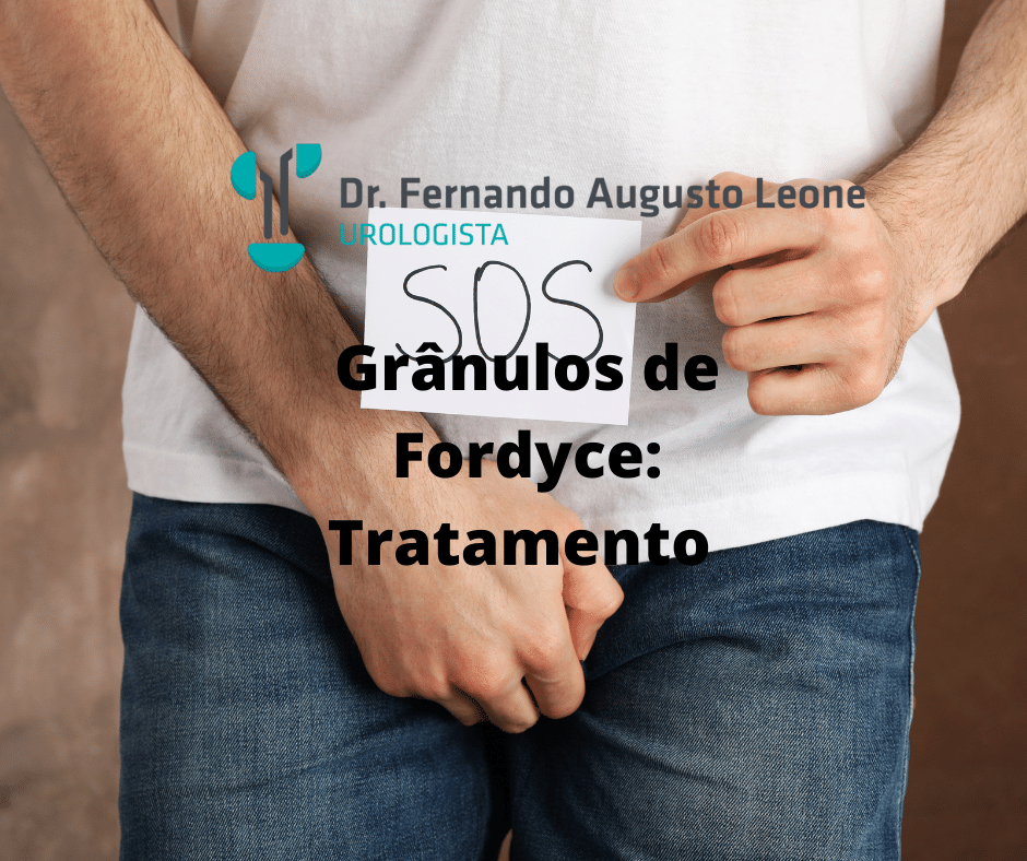 grânulos de fordyce tratamento urologista em bh dr fernando leone