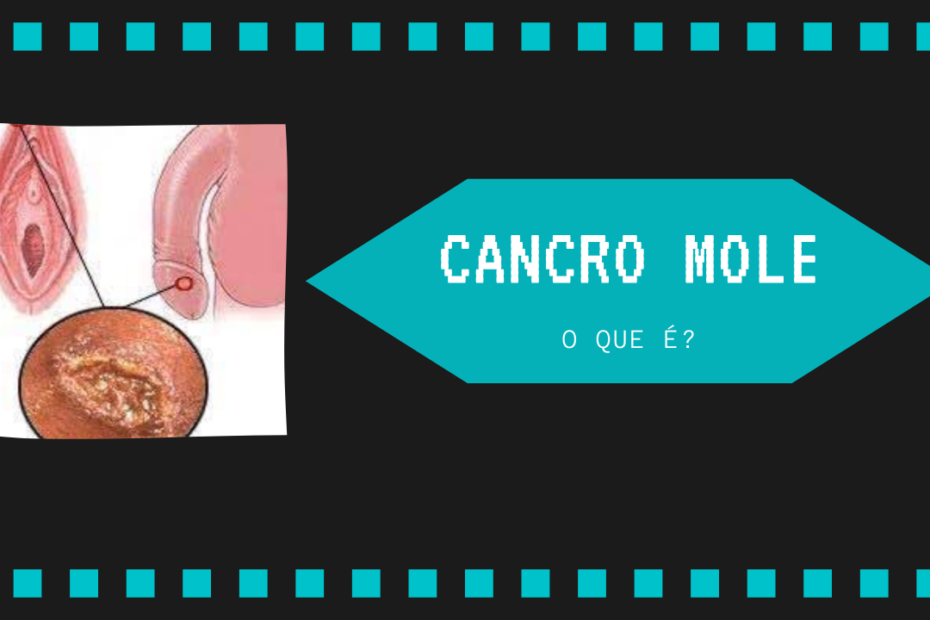 cancro mole