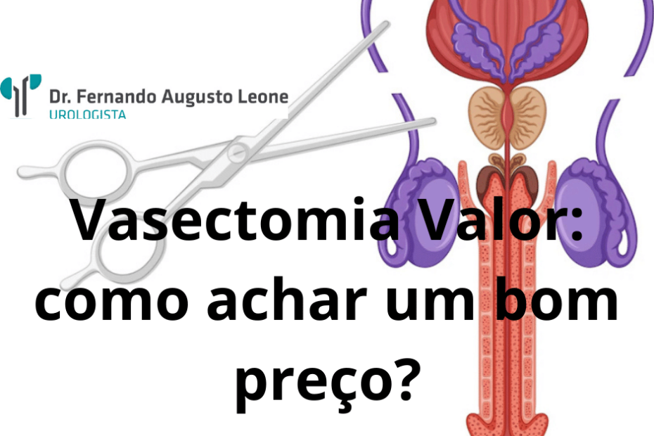 vasectomia valor