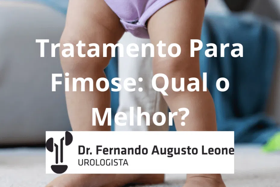 Tratamento Para Fimose: Qual o Melhor?