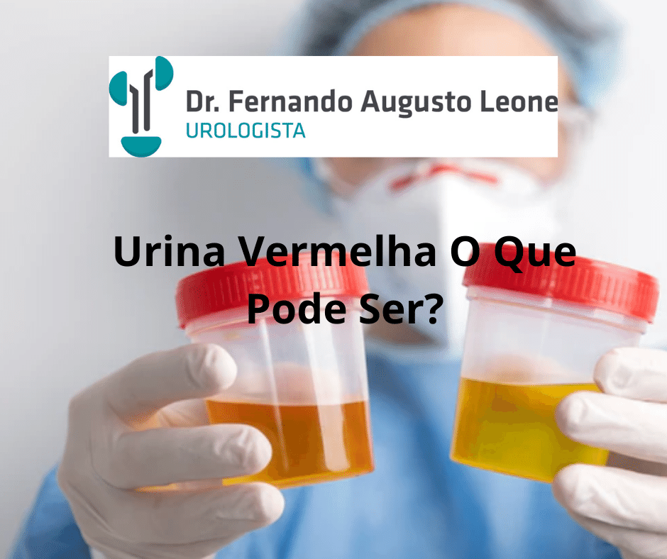 Urina Vermelha O Que Pode Ser? Dr. Fernando Leone - Urologista BH - Uro BH