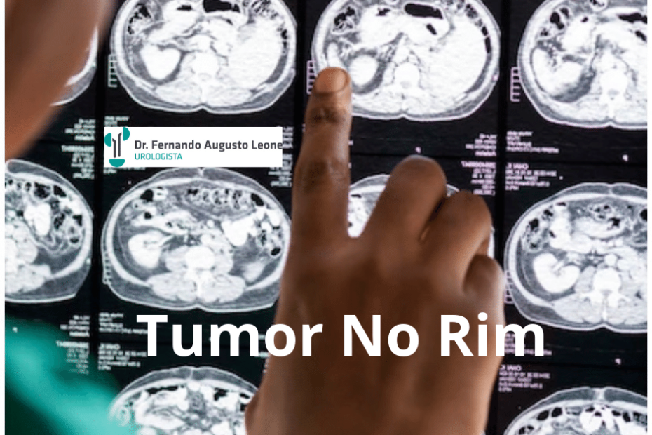 tumor no rim
