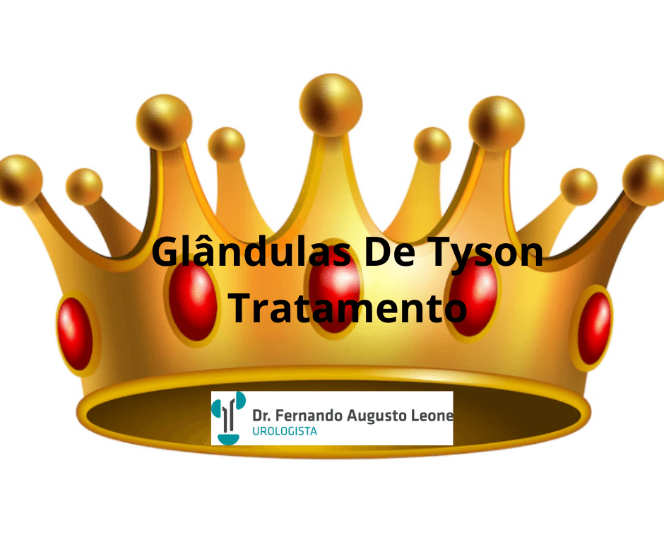 Glândulas De Tyson Tratamento - Dr. Fernando Leone - Urologista BH - Uro BH