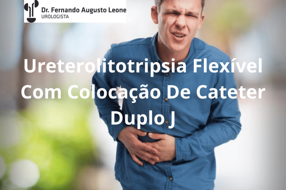 Ureterolitotripsia Flexível Com Colocação De Cateter Duplo J