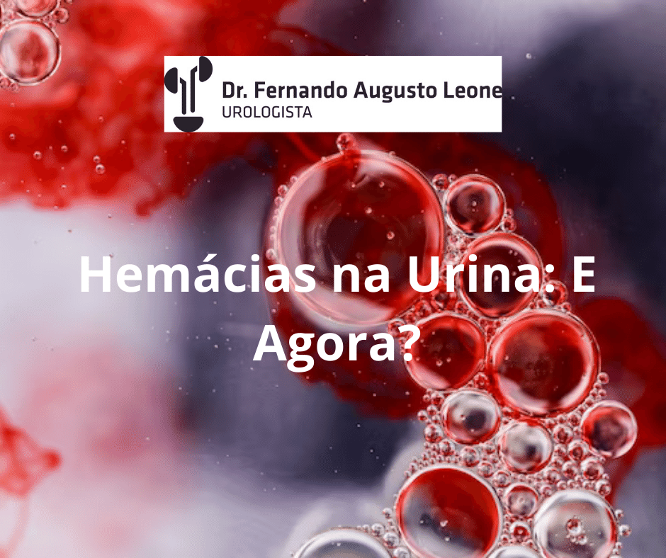 Hem Cias Na Urina E Agora Dr Fernando Leone Urologista Bh