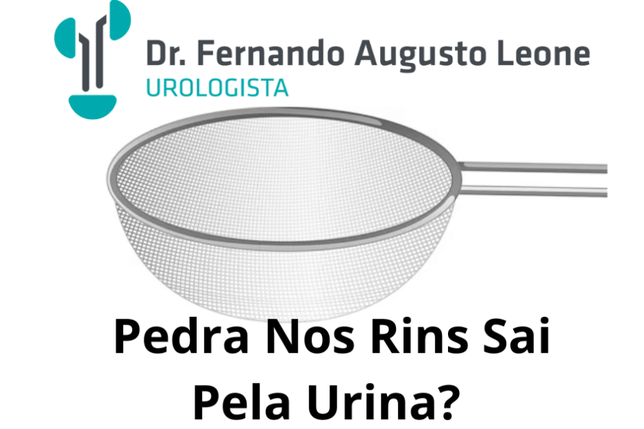 Pedra Nos Rins Sai Pela Urina Dr Fernando Leone Urologista Bh 1986