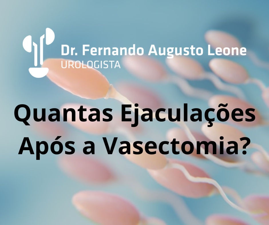 Quantas Ejaculações Após A Vasectomia Dr Fernando Leone Urologista Bh 5246