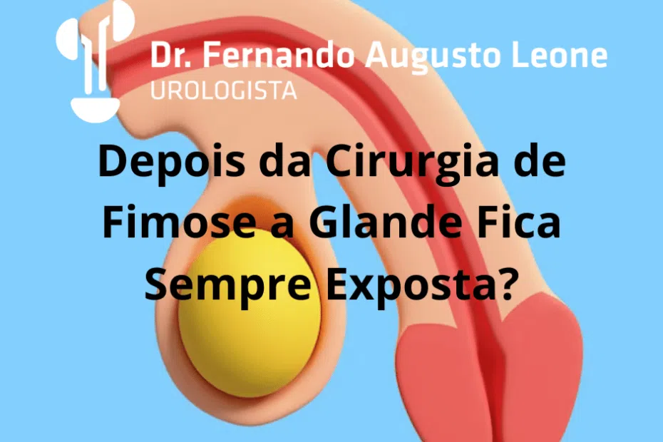Depois da Cirurgia de Fimose a Glande Fica Sempre Exposta?