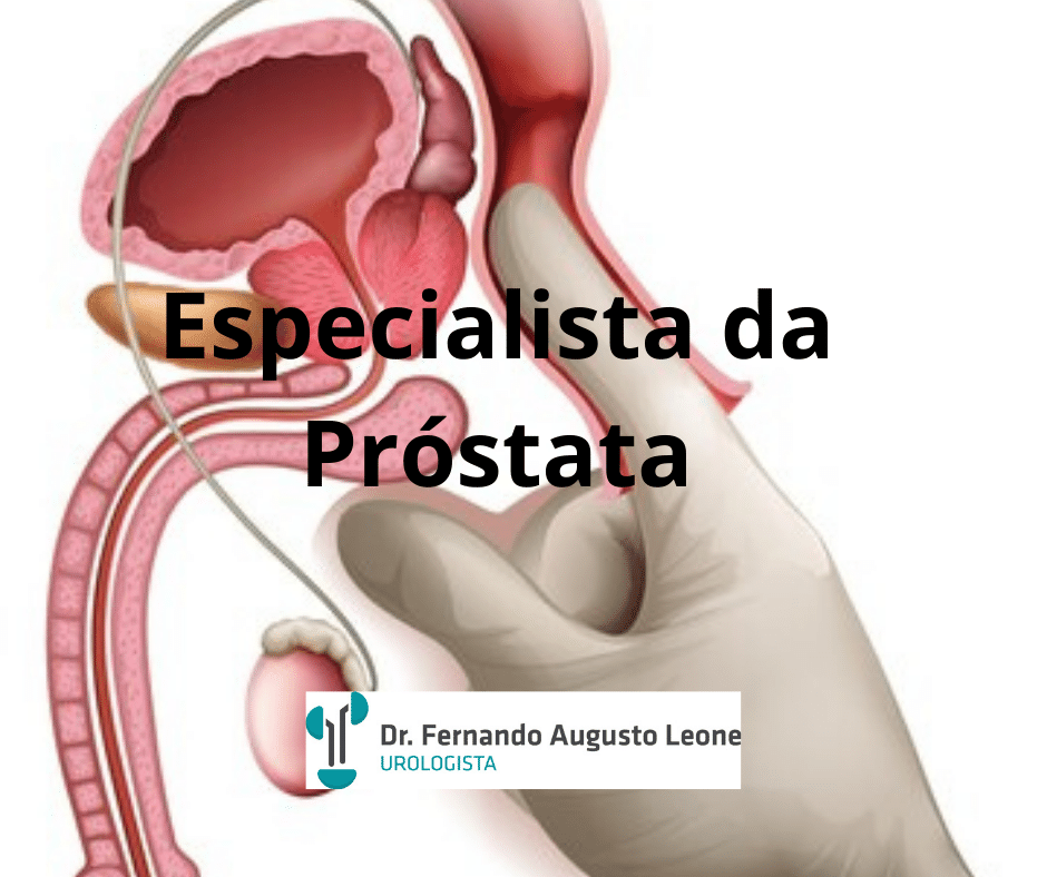 Especialista Da Próstata Dr Fernando Leone Urologista Bh 9142