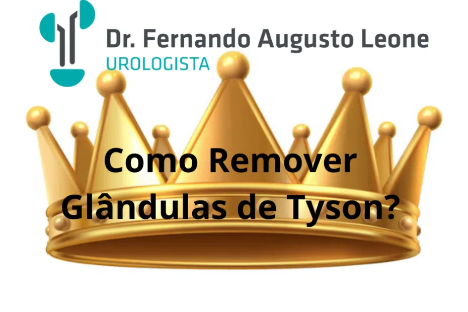 Como Remover Glândulas de Tyson?