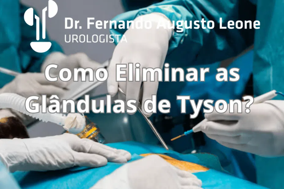 glândulas de tyson como eliminar