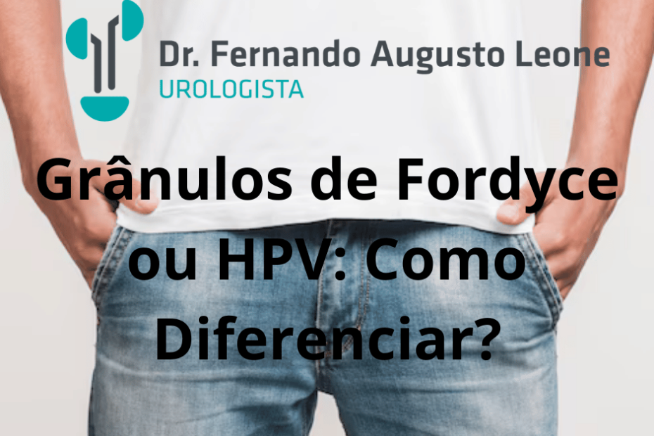 grânulos de fordyce ou hpv