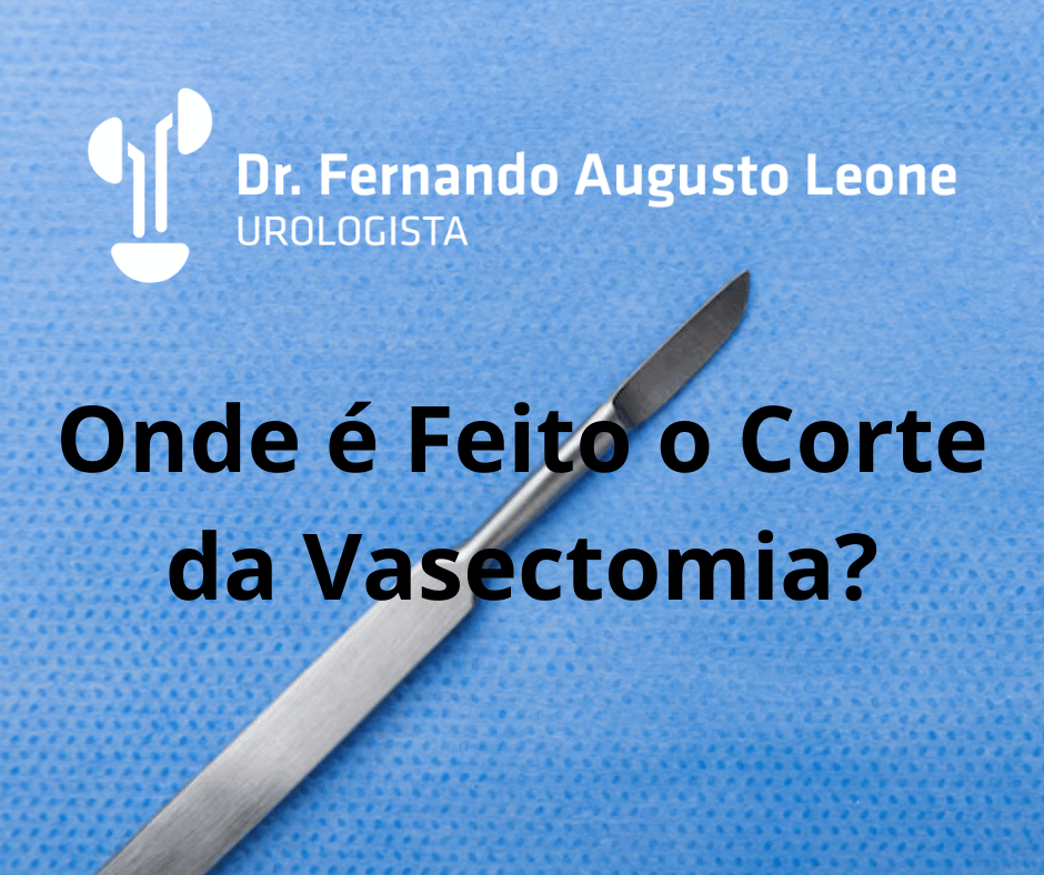 Onde é Feito o Corte da Vasectomia? Dr. Fernando Leone - Urologista BH
