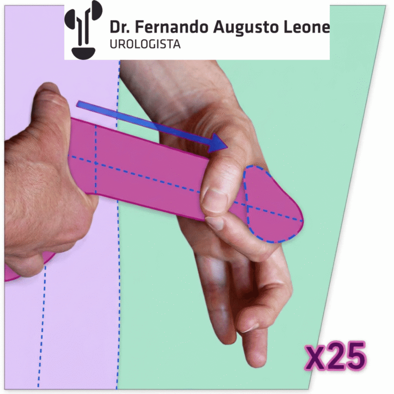 Técnica de Jelqing